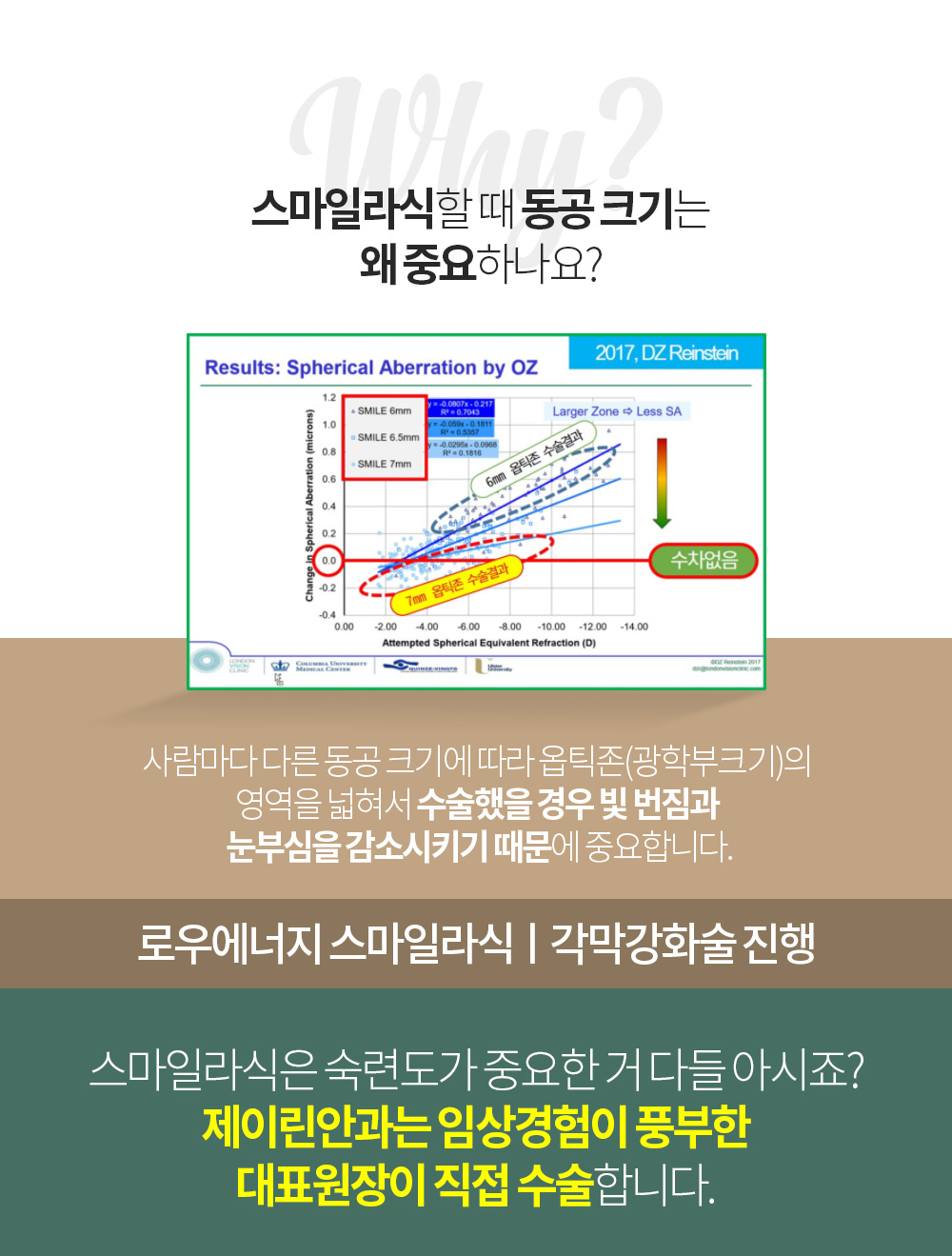 스마일라식할 때 동공 크기는 왜 중요하나요?