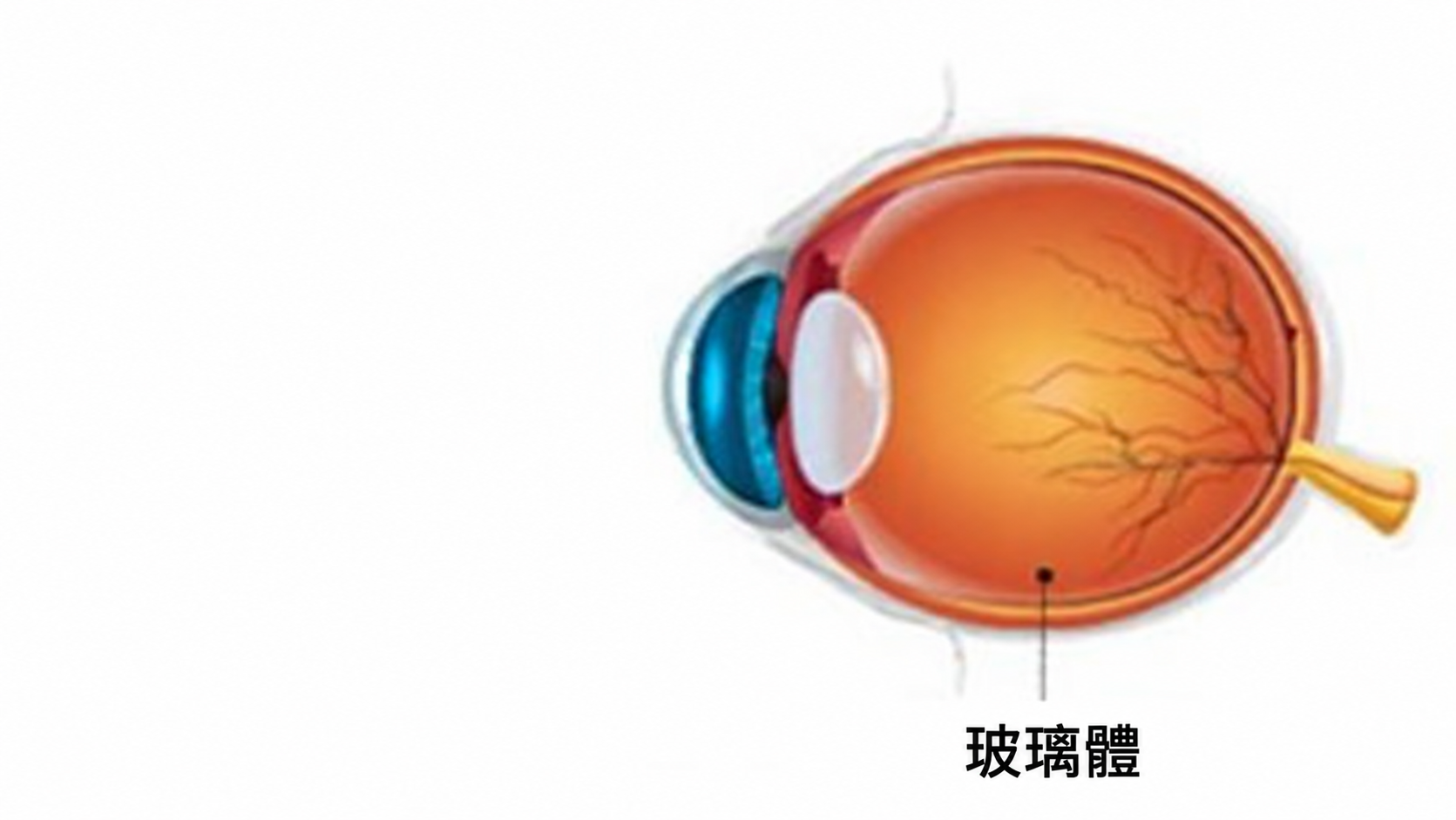 玻璃體位置示意